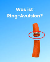 Was ist Ring-Avulsion? - SOLID RINGS
